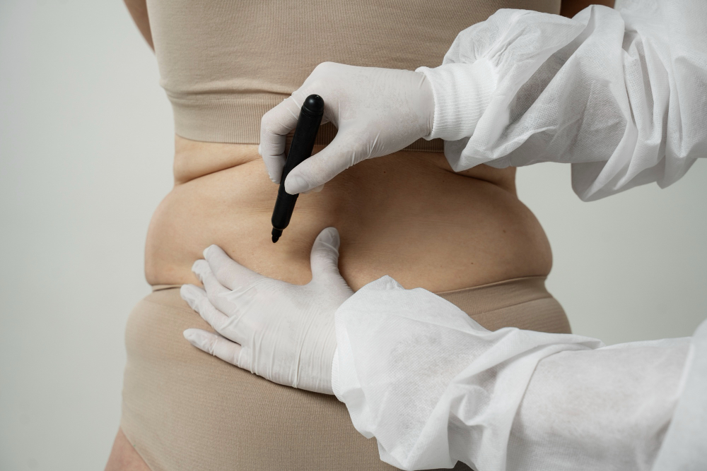 When Can I Take A Bath After A Tummy Tuck? Safe Bathing Guidelines