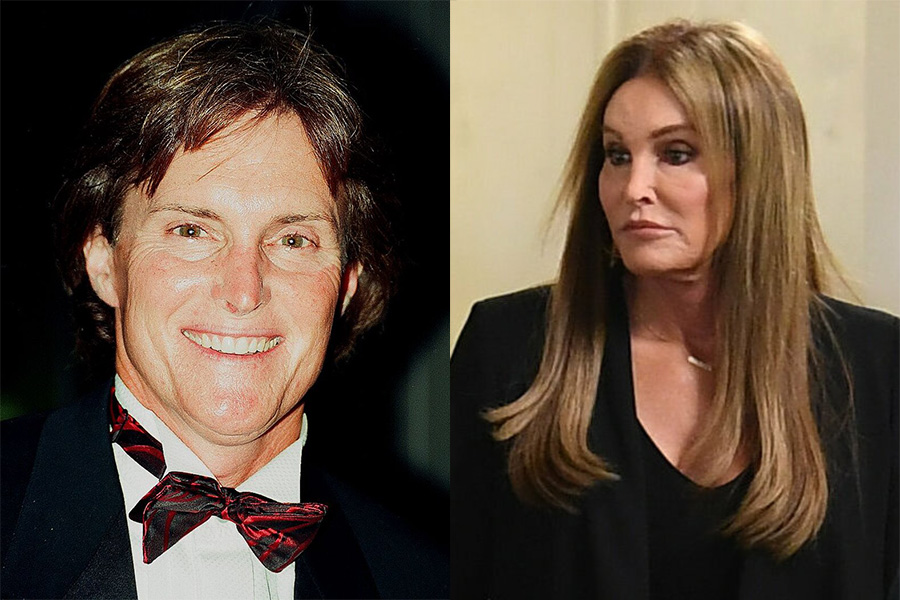 Caitlyn Jenner’s Transition: Embracing Identity Through Vaginoplasty